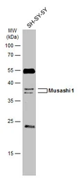 Anti-Musashi 1 antibody [N3C3] used in Western Blot (WB). GTX101540