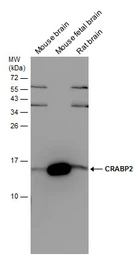 Anti-CRABP2 antibody [N1C3] used in Western Blot (WB). GTX101551