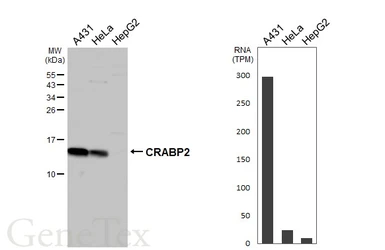Anti-CRABP2 antibody [N1C3] used in Western Blot (WB). GTX101551