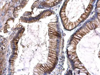 Anti-FLT3 antibody used in IHC (Paraffin sections) (IHC-P). GTX101556