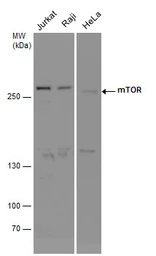 Anti-mTOR antibody [C1], Internal used in Western Blot (WB). GTX101558