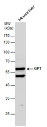 Anti-GPT antibody [N1N3] used in Western Blot (WB). GTX101559