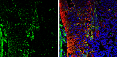 Anti-Galectin 1 antibody used in IHC (Frozen sections) (IHC-Fr). GTX101566