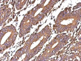 Anti-Galectin 1 antibody used in IHC (Paraffin sections) (IHC-P). GTX101566