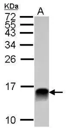 Anti-Galectin 1 antibody used in Western Blot (WB). GTX101566