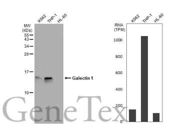 Anti-Galectin 1 antibody used in Western Blot (WB). GTX101566