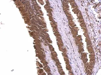 Anti-alpha Adducin antibody used in IHC (Paraffin sections) (IHC-P). GTX101574