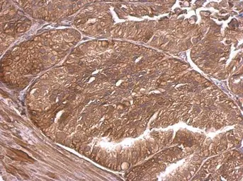 Anti-alpha Adducin antibody used in IHC (Paraffin sections) (IHC-P). GTX101574