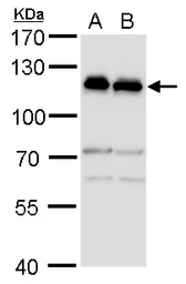 Anti-alpha Adducin antibody used in Western Blot (WB). GTX101574