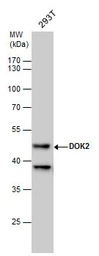 Anti-DOK2 antibody [N1C1] used in Western Blot (WB). GTX101577
