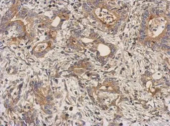 Anti-LEFTY2 antibody used in IHC (Paraffin sections) (IHC-P). GTX101582