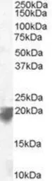 Anti-VPS29 antibody, C-term used in Western Blot (WB). GTX10160