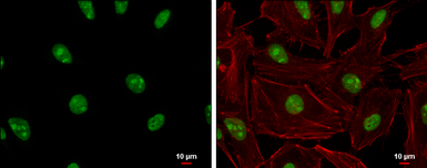 Anti-ADAR1 antibody [N3C1], Internal used in Immunocytochemistry/ Immunofluorescence (ICC/IF). GTX101602