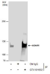adar1 antibody