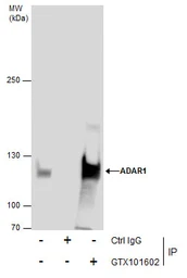Anti-ADAR1 antibody [N3C1], Internal used in Immunoprecipitation (IP). GTX101602
