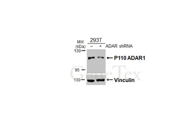 Anti-ADAR1 antibody [N3C1], Internal used in Western Blot (WB). GTX101602