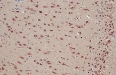 Anti-ADAR1 antibody [N3C1], Internal used in IHC (Paraffin sections) (IHC-P). GTX101602