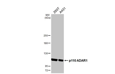 Anti-ADAR1 antibody [N3C1], Internal used in Western Blot (WB). GTX101602