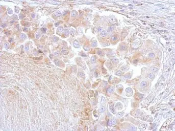 Anti-Annexin VI antibody [C2C3], C-term used in IHC (Paraffin sections) (IHC-P). GTX101604
