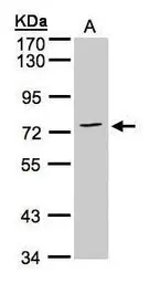 Anti-Annexin VI antibody [C2C3], C-term used in Western Blot (WB). GTX101604
