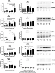 Anti-p62Dok antibody [N1C1] used in Western Blot (WB). GTX101610