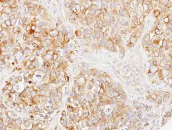 Anti-p62Dok antibody [N1C1] used in IHC (Paraffin sections) (IHC-P). GTX101610