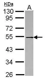Anti-p62Dok antibody [N1C1] used in Western Blot (WB). GTX101610