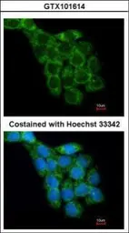 Anti-RPL8 antibody used in Immunocytochemistry/ Immunofluorescence (ICC/IF). GTX101614