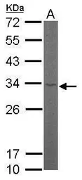 Anti-RPL8 antibody used in Western Blot (WB). GTX101614
