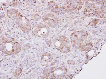 Anti-RPL8 antibody used in IHC (Paraffin sections) (IHC-P). GTX101614