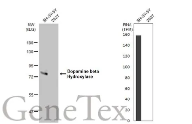 Anti-Dopamine beta Hydroxylase antibody used in Western Blot (WB). GTX101616