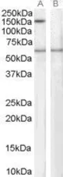 Anti-SIPA1 antibody, C-term used in Western Blot (WB). GTX10162