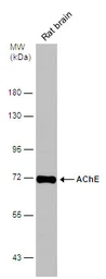 Anti-AChE antibody used in Western Blot (WB). GTX101648