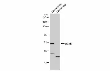 Anti-AChE antibody used in Western Blot (WB). GTX101648