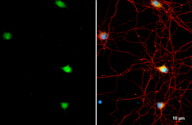 Anti-AChE antibody used in Immunocytochemistry/ Immunofluorescence (ICC/IF). GTX101648