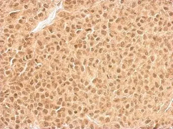 Anti-RPL11 antibody used in IHC (Paraffin sections) (IHC-P). GTX101651