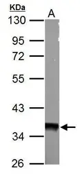 Anti-AMPK gamma 1 antibody used in Western Blot (WB). GTX101661