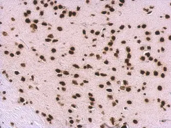 Anti-SNRPA antibody used in IHC (Paraffin sections) (IHC-P). GTX101664