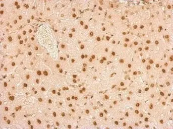 Anti-SNRPA antibody used in IHC (Paraffin sections) (IHC-P). GTX101664