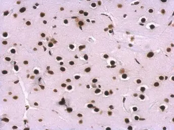 Anti-SNRPA antibody used in IHC (Paraffin sections) (IHC-P). GTX101664