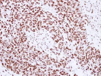 Anti-SNRPA antibody used in IHC (Paraffin sections) (IHC-P). GTX101664