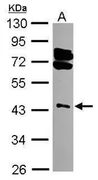 Anti-RING1 antibody [N1N3] used in Western Blot (WB). GTX101671