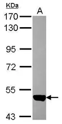 Anti-ACVRL1 antibody [C1C3] used in Western Blot (WB). GTX101672