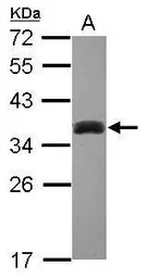 Anti-SULT1A3 antibody [N1C3] used in Western Blot (WB). GTX101675