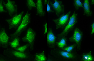 Anti-Calnexin antibody [N3C2], Internal used in Immunocytochemistry/ Immunofluorescence (ICC/IF). GTX101676