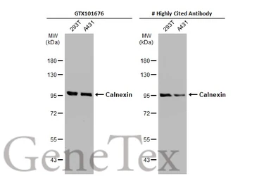 Anti-Calnexin antibody [N3C2], Internal used in Western Blot (WB). GTX101676