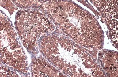 Anti-Calnexin antibody [N3C2], Internal used in IHC (Paraffin sections) (IHC-P). GTX101676