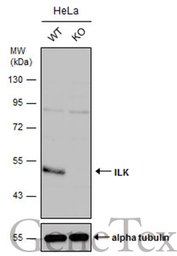 Anti-ILK antibody [N1C1] used in Western Blot (WB). GTX101691