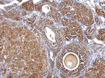 Anti-Septin 2 antibody [N1N3] used in IHC (Paraffin sections) (IHC-P). GTX101693
