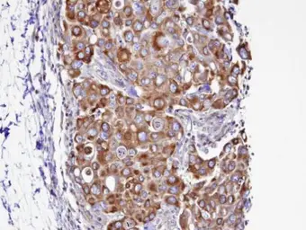 Anti-Septin 2 antibody [N1N3] used in IHC (Paraffin sections) (IHC-P). GTX101693